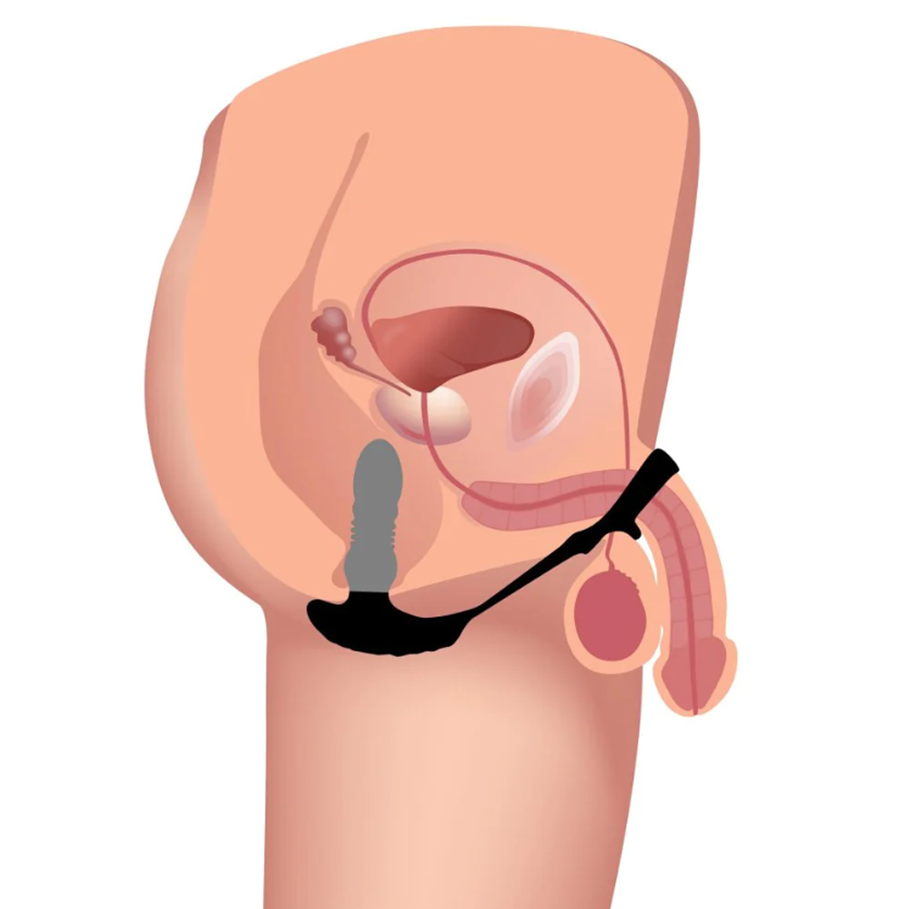 Silicone anal plug with a remote-controlled thrusting shaft and cock ring.